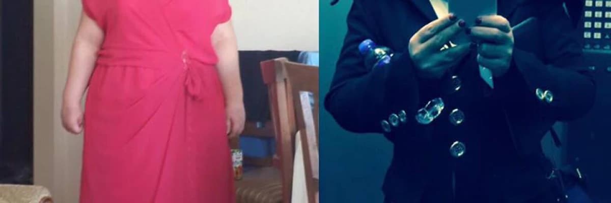 Obezite Ameliyatı Sonrasında Oluşan Çapraz Bağımlılık