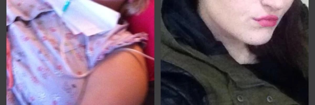 Ameliyat Sonrası Olmamış Gibi Acıkma Hissinin Sebepleri