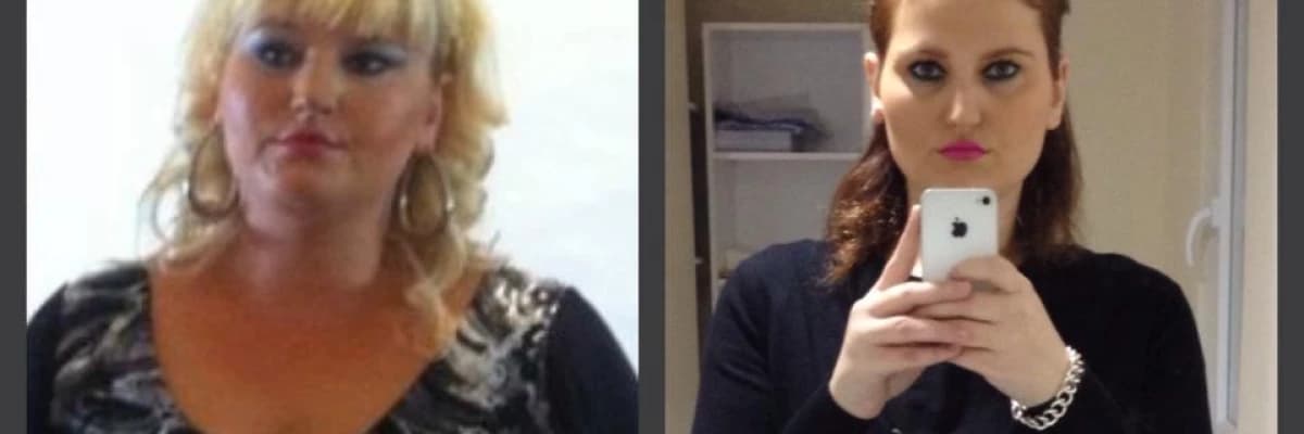 Kilo Kaybının (zayıflamanın) Sosyal ve Psikolojik Etkileri