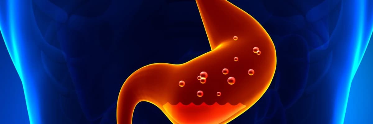 Morbid Obezitenin Cerrahi Tedavisinde Tüp Mide ve Gastrik Bypass