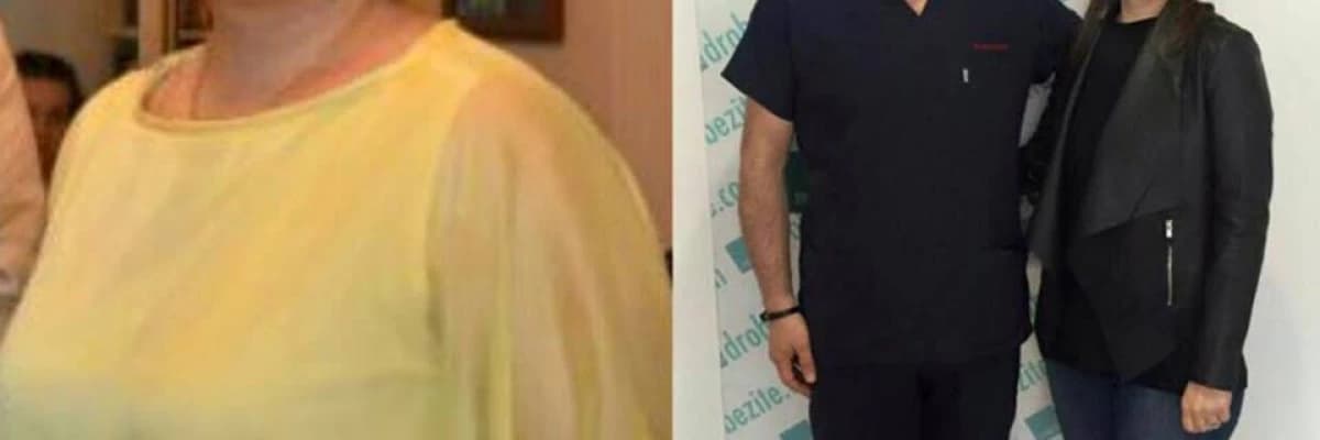 Şeker Hastalığı Ameliyatı Öncesi ve Sonrası