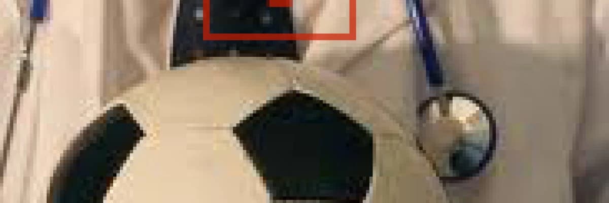 Sporcu Fıtıklarında Tanı Ve Tedavi