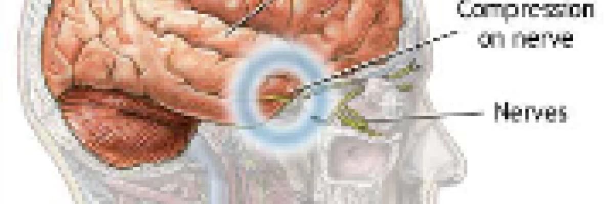 Prolaktinoma Hakkında (Hipofiz Tümörü)