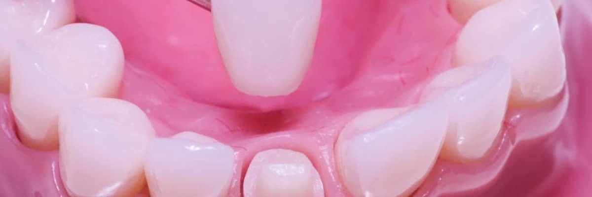 TAM PORSELEN KURONLAR