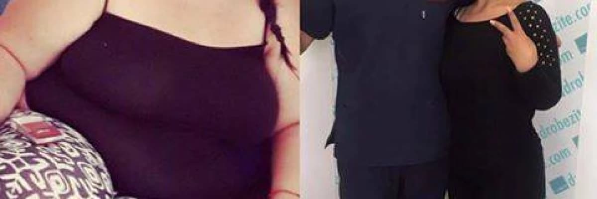 Şişmanlıktan Zayıflık Yolunda Yaşananlar Adım Adım **6