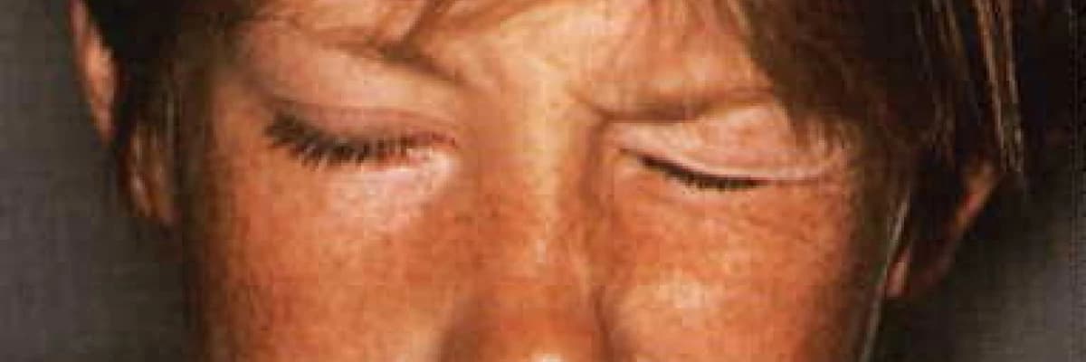 Tikler Hakkında Merak Ettikleriniz.