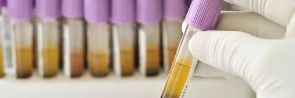 Diyete başlamadan yapılması gereken tahliller