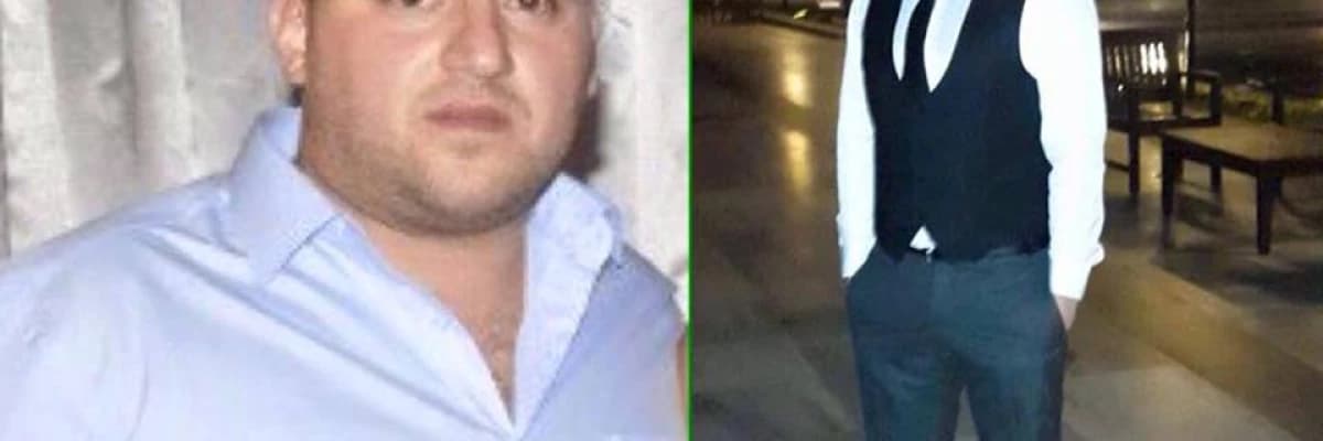 Obezite Tedavisi Nasıl Yapılıyor?