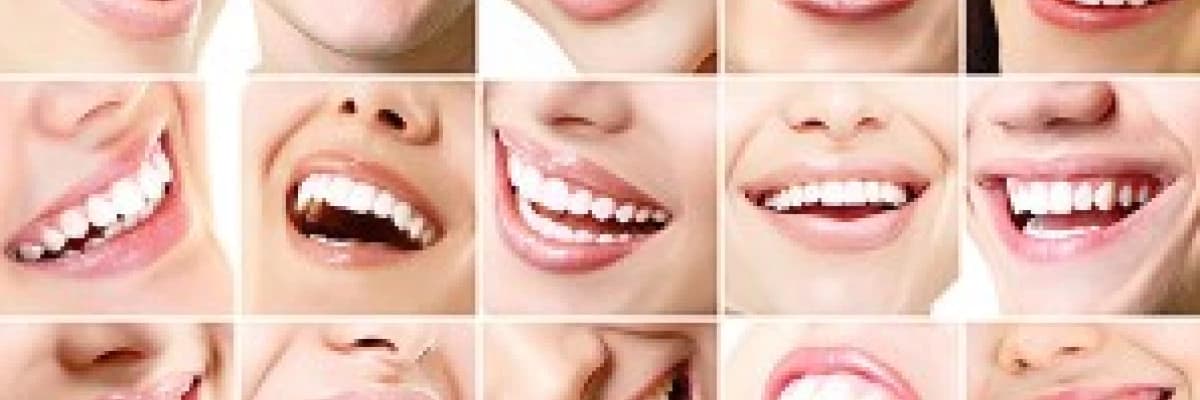 Gülüş tasarımı nasıl yapılır? Gülüş tasarımında nelere dikkat edilir?