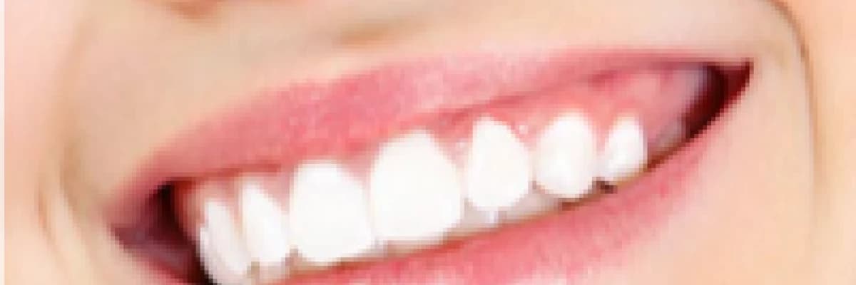 Diş beyazlatma nasıl yapılır? Diş beyazlatma zararlı mıdır?