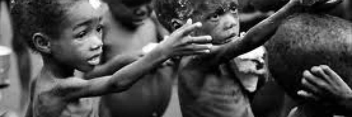 Malnütrisyonda Beslenme -Malnütrisyon