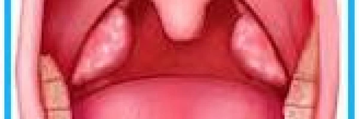 Bademcik ve Geniz Eti Alınması