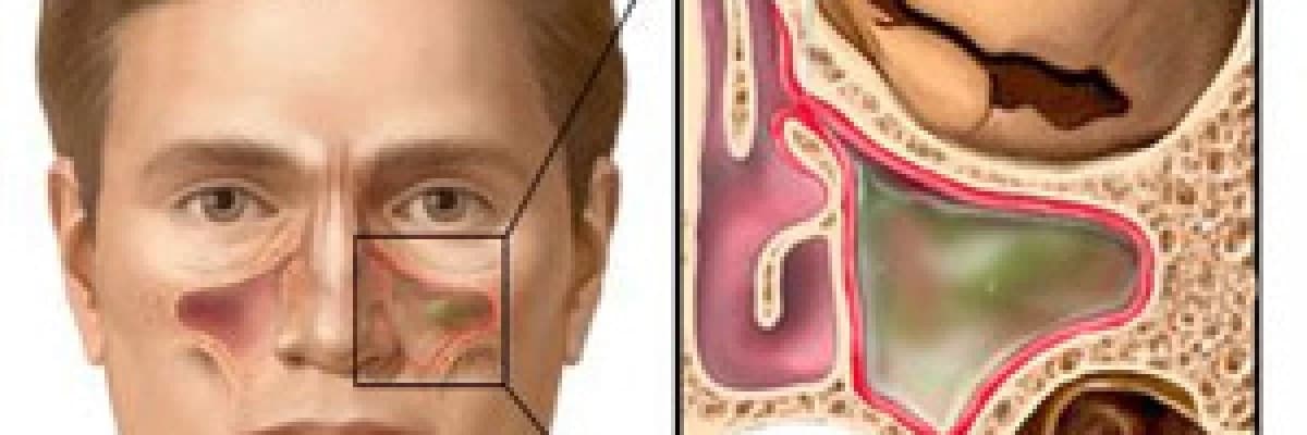 Sinüsler Nedir ve Ne İşe Yararlar?