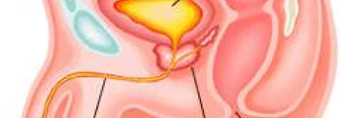 Prostat Hastalıkları Nelerdir?