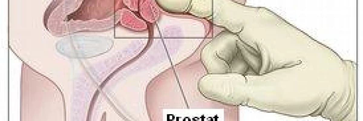 BPH NEDİR? BPH ile ilişkili şikayetler nelerdir?