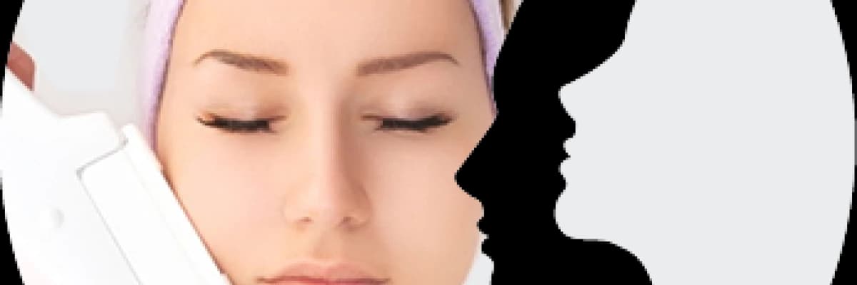 Lazer Epilasyon Hakkında Her Şey