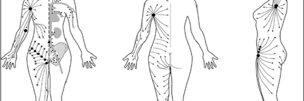 LENF SİSTEMİ VE LENFÖDEM