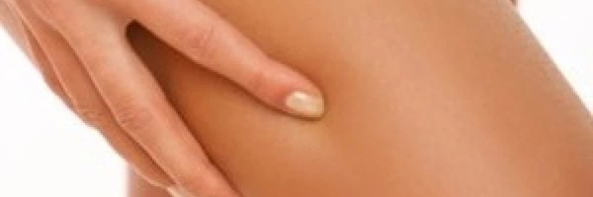 SELÜLİT NEDİR, NASIL OLUŞUR?