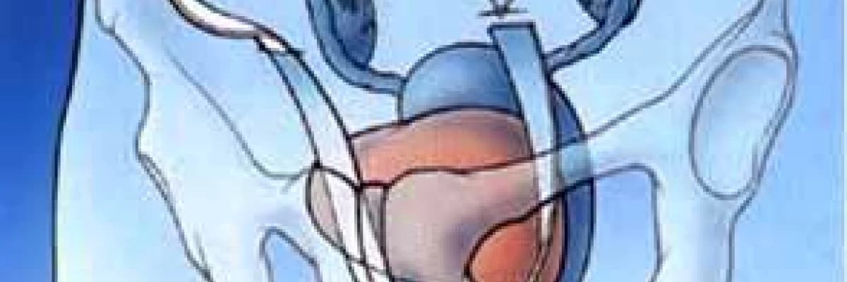 kadınlarda idrar kaçırma ve tedavi seçenekleri