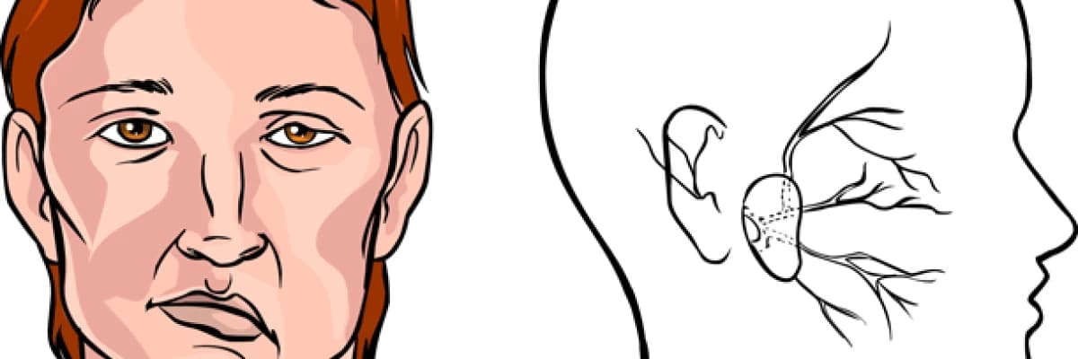 Felç ve İnme Nedir? Neden olur?