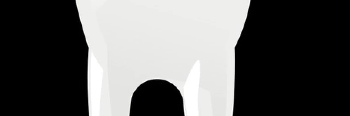 Ağız İçinde Uygulanan Cerrahi Operasyonlar Sonrası Bakım