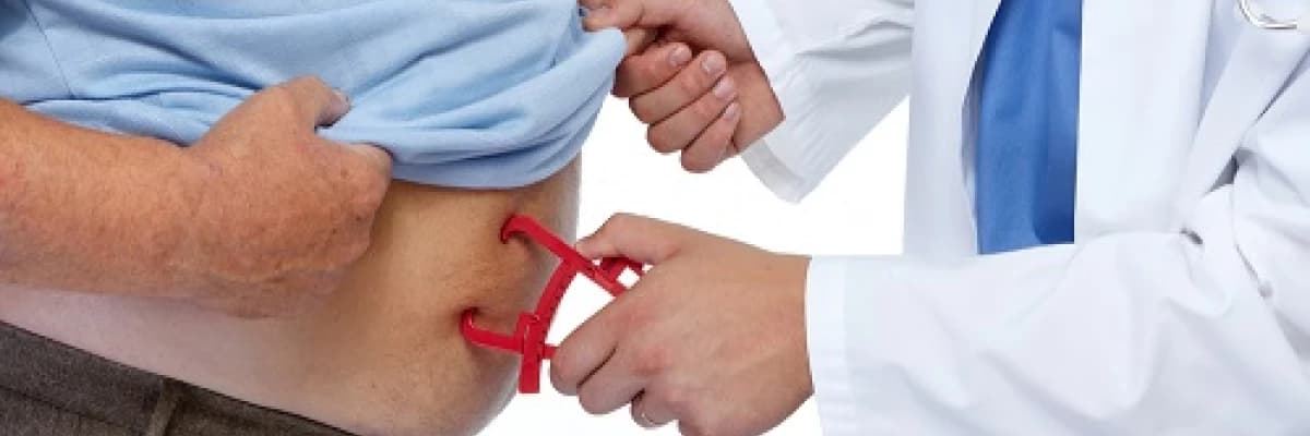 Tüp mide ameliyatı ve obezite cerrahisi