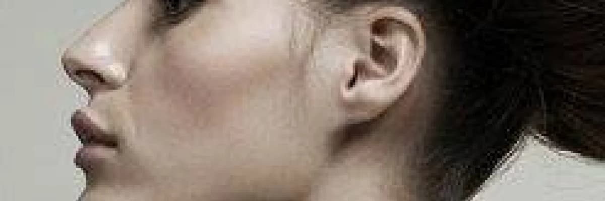 GIDI BÖLGESİ VE YÜZ KONTÜRÜ DÜZENLEMEDE ULTRASONİK LİPOSUCTİON