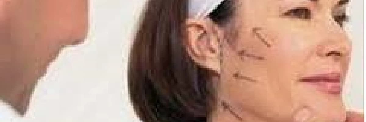 MİNİ YÜZ GERME OPERASYONU ( SHORT SCAR MINI FACE LİFT )