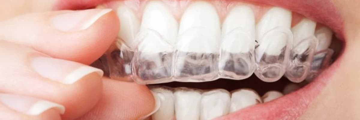 ORTODONTİK PROBLEMLERİN OLUŞMA NEDENLERİ