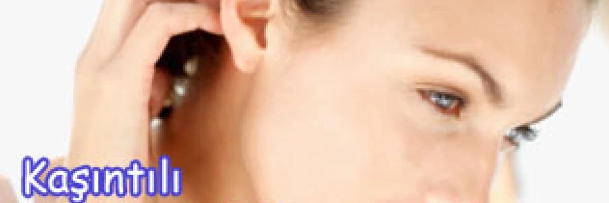 Kaşıntılı deri hastalıkları