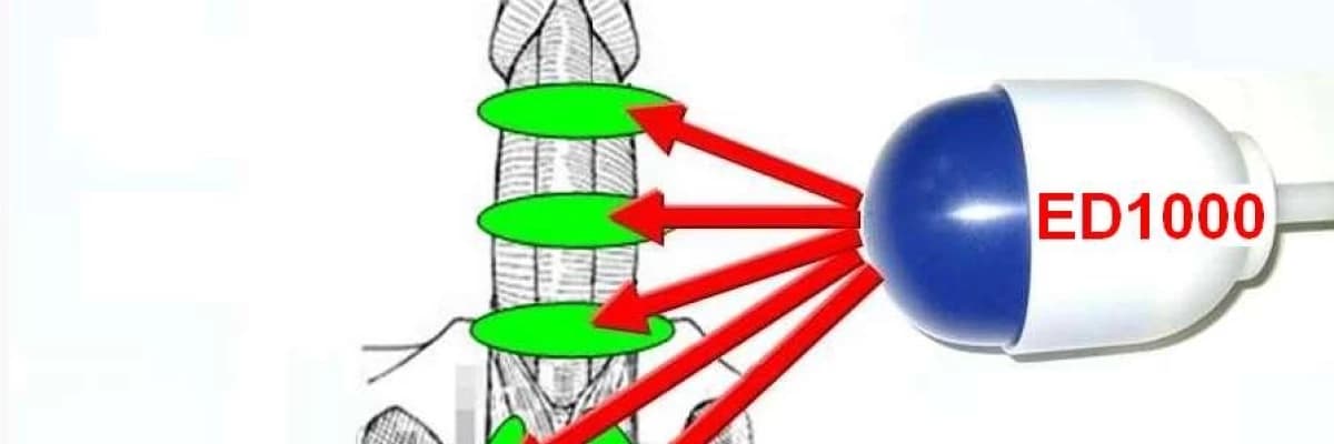 Sertleşme bozukluğu ve tedavisi nedir?