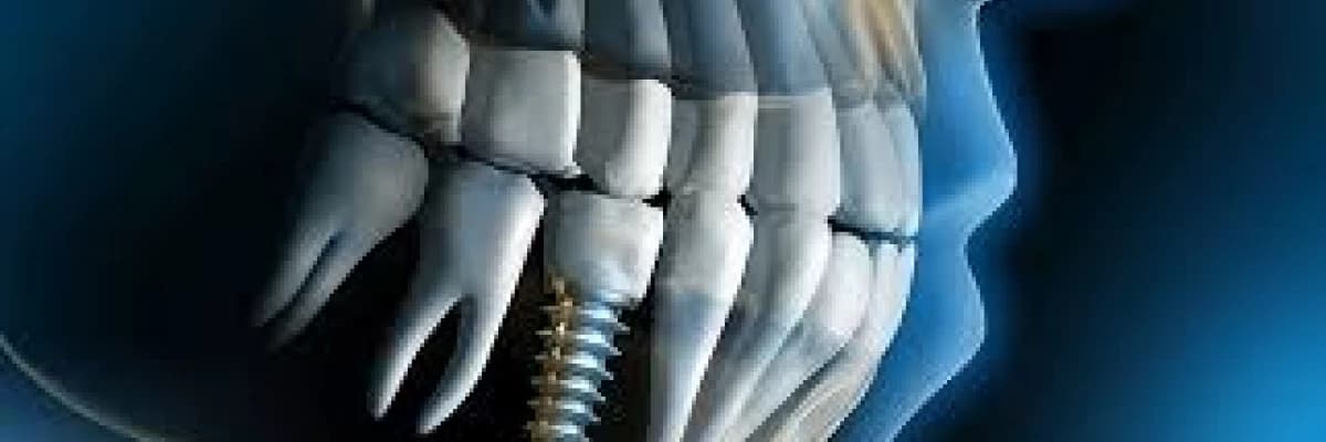 Dişsizliğe 1 Günde Çözüm