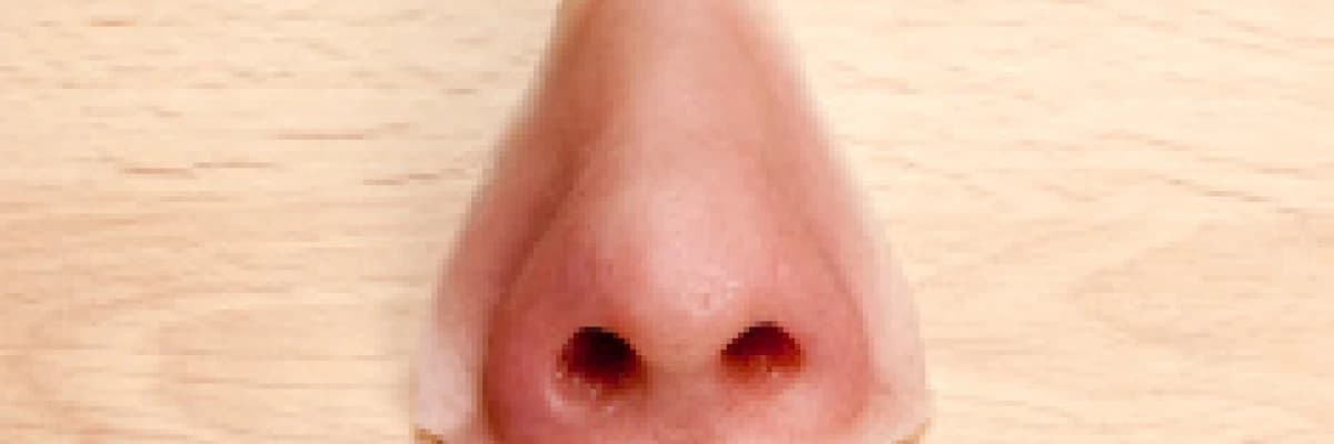 PRİMER RİNOPLASTİ