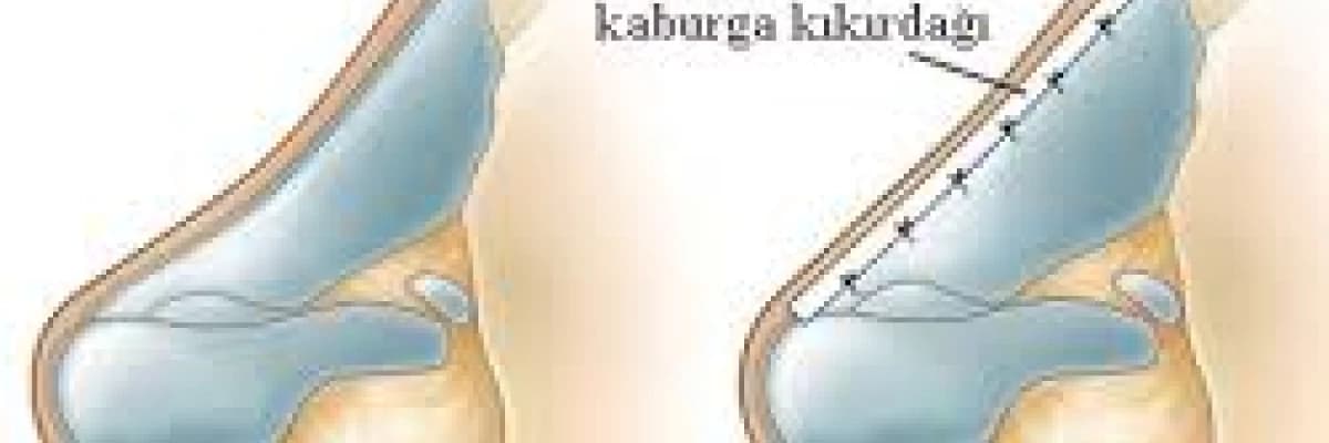 BURUN DÜZELTME CERRAHİSİ (REVİZYON RİNOPLASTİ)