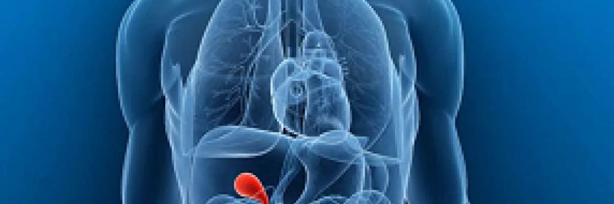 Safra Kesesi Taşı, teşhis, tedavi ve laparoskopik ameliyat