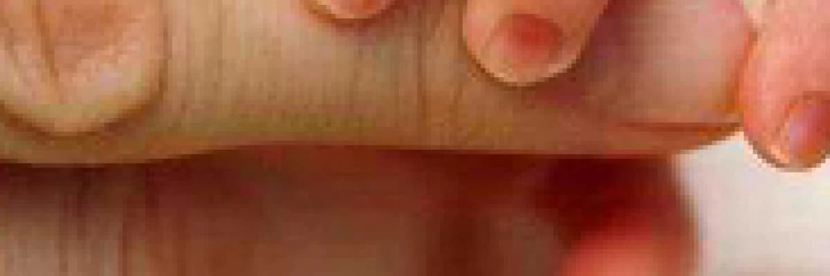 Erken doğum neden olur