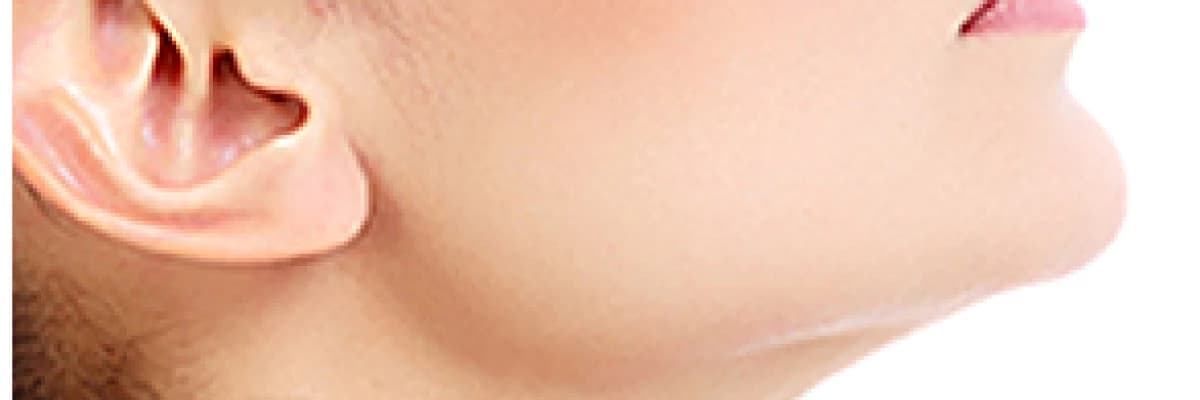 Çene estetiği ve uygulaması