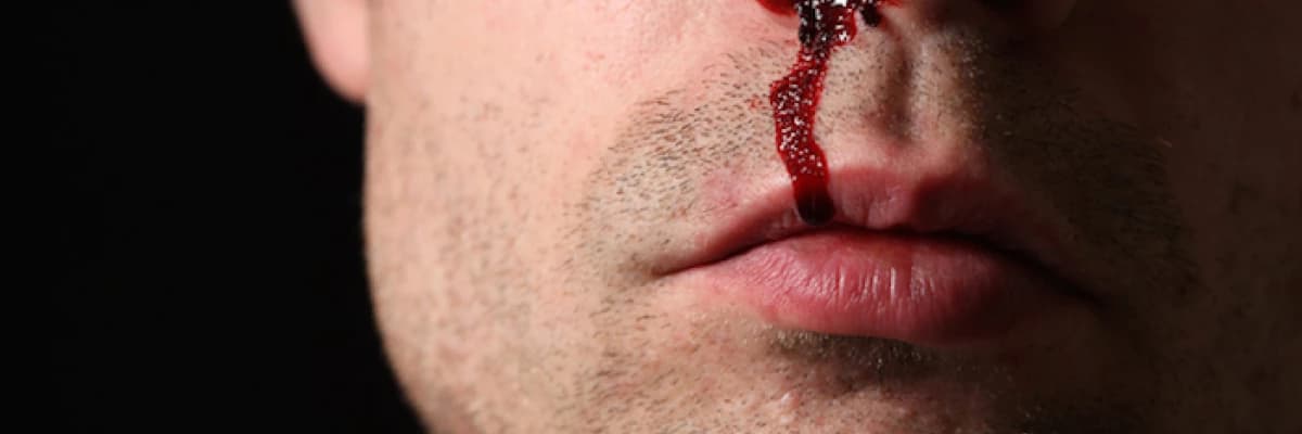 Burun kanamasında yapılması gerekenler