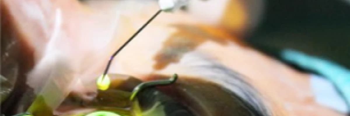 Keratokonus nedir, tedavisi nasıldır ?