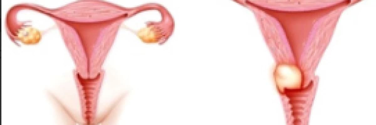 Genital Enfeksiyonlar ve Sebepleri