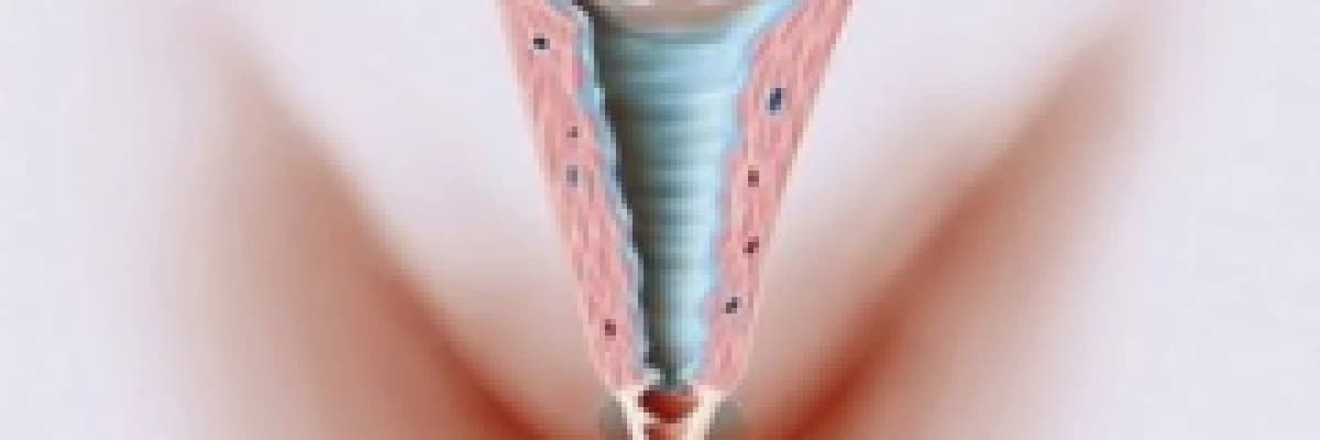 GENİTAL  ESTETİK,ESTETİK KAVRAMINA JİNEKOLOJİK YAKLAŞIM…