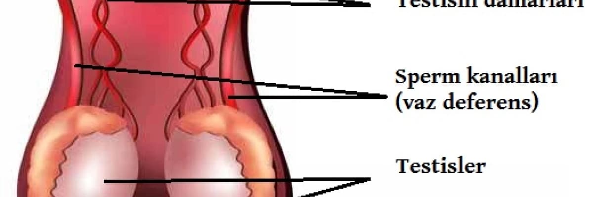 EN GÜVENİLİR DOĞUM KONTROL YÖNTEMİ (VAZEKTOMİ)
