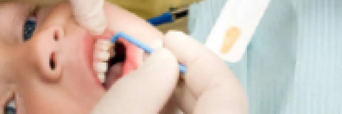 Fissür Örtücü (Diş Aşısı) Nedir? Nasıl Uygulanır?