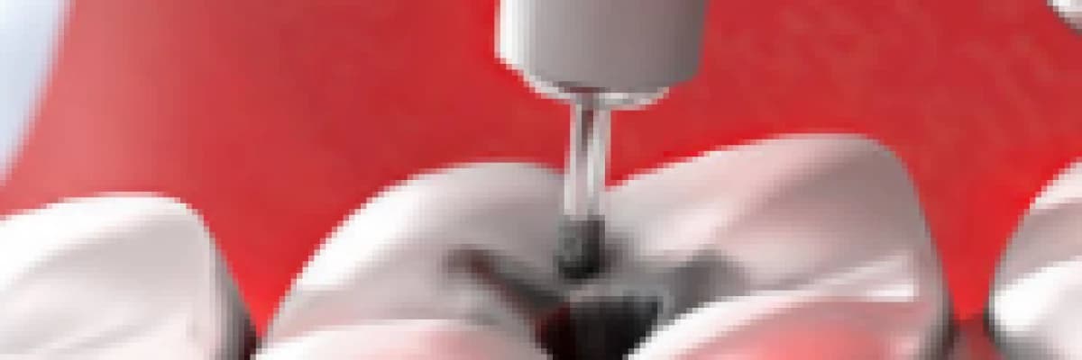 Dolgu Yapılan Dişin Çürümemesi İçin Ne Yapmalıyım ?