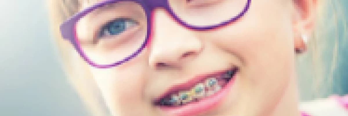 Ortodontik Tedavi Süresince Dişlerim Çürür Mü ?