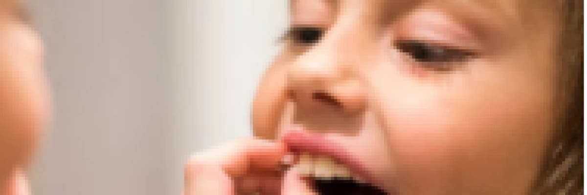 Çocuğum Düştü, Ön Dişleri Yerinden Fırladı Ne Yapmalıyım?