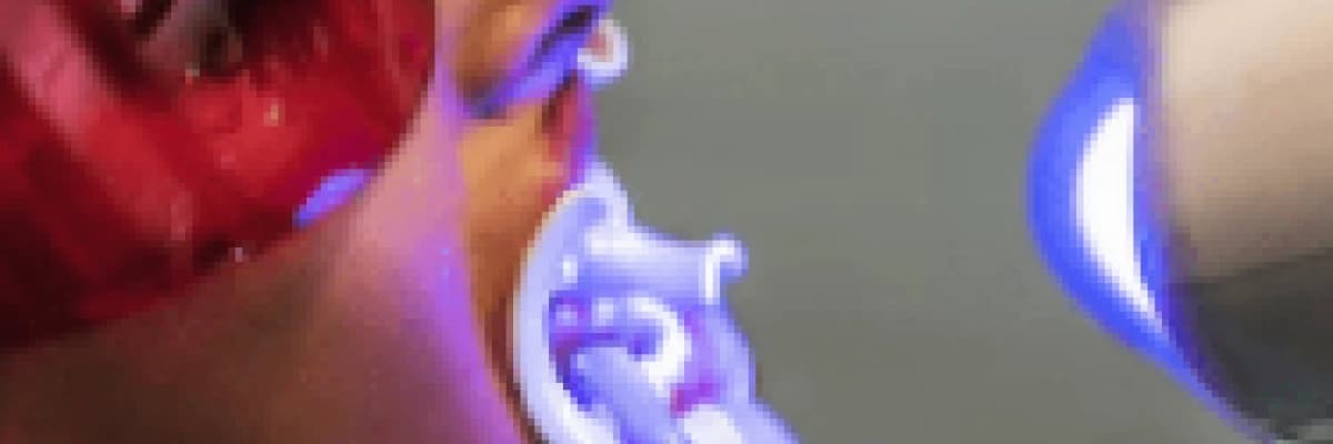 Diş Beyazlatma Nasıl Oluyor ?