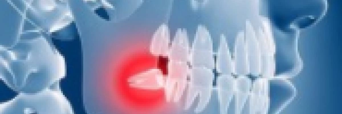 Gömülü Dişler (Yirmi Yaş Diş Çekimi)