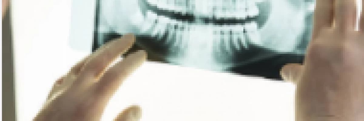 Röntgen (Radyografi)