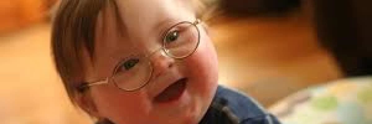 Down Sendromu Psikiyatrik Belirtileri